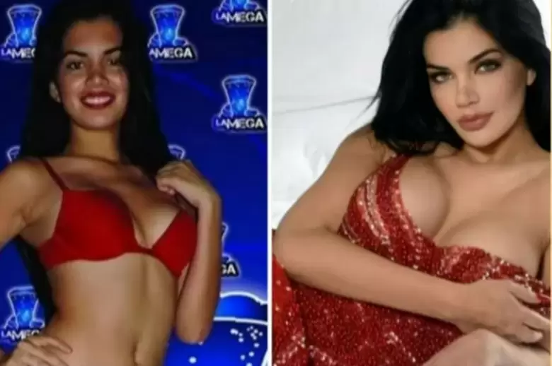 Antes y despus de Samantha Batallanos