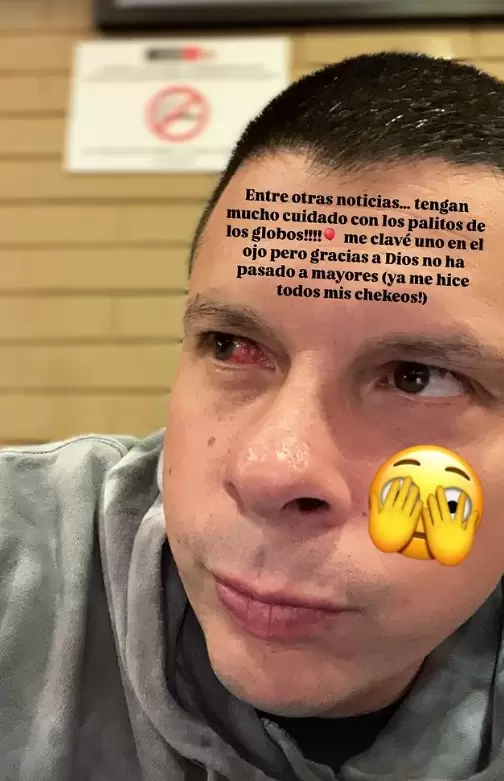 Mario Hart revel que sufri una lesin en su ojo