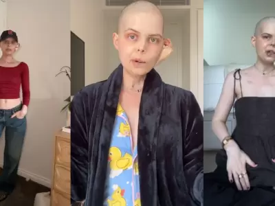 Muere la influencer Bella Bradford