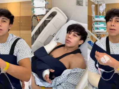 Influencer se rompe en brazo jugando 'vencidas'