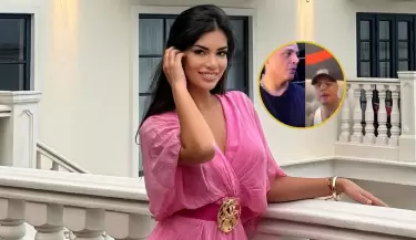 Samantha Batallanos se burl de la nueva operacin de Jonathan Maicelo.