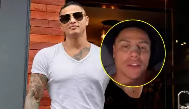 Jonathan Maicelo responde a quines se burlan tras operarse la nariz