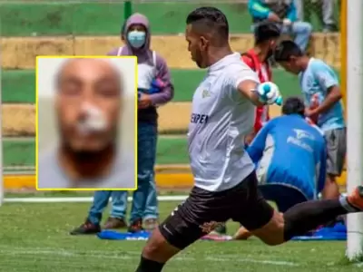 Futbolista termina en la comisara tras pelea que dej un hombre desfigurado