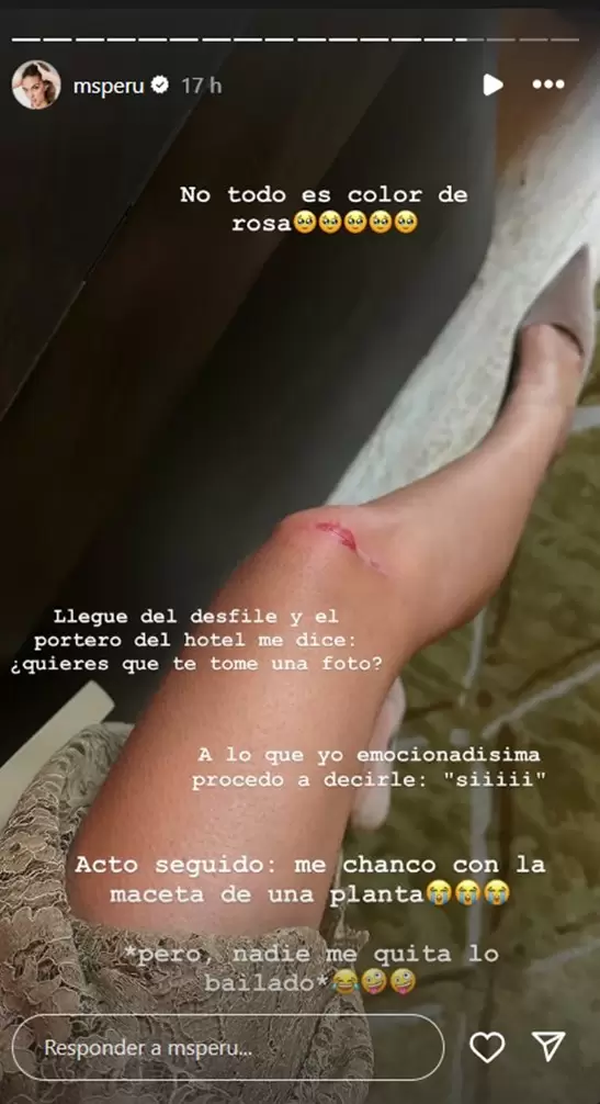 Natalie Vrtiz sufri accidente tras desfile de diseador. (Instagram)