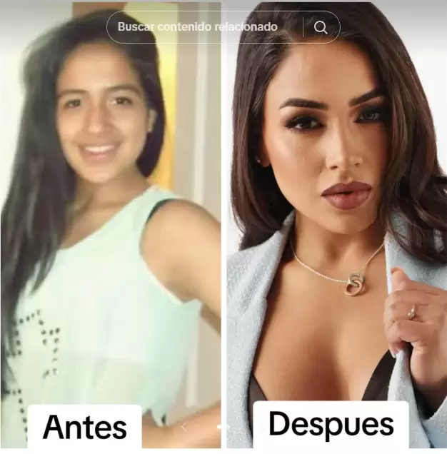 El antes y despus de Onelia Molina