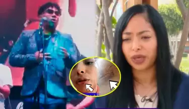 Salsero es denunciado por su expareja tras fuerte agresin fsica