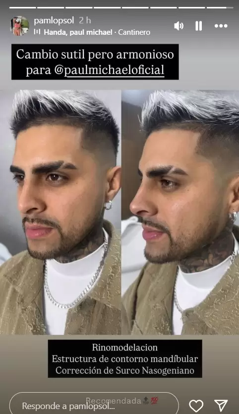 Paul Michael comparti en sus redes sociales su retoque esttico.