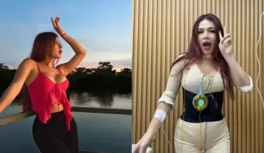 Uchul se defiende tras crticas por sus cirugas