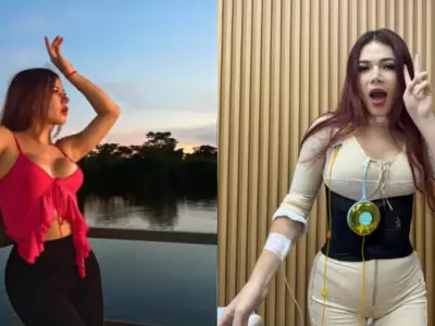 Uchul se defiende tras crticas por sus cirugas