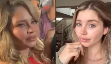Flavia Laos habla de sus cirugas