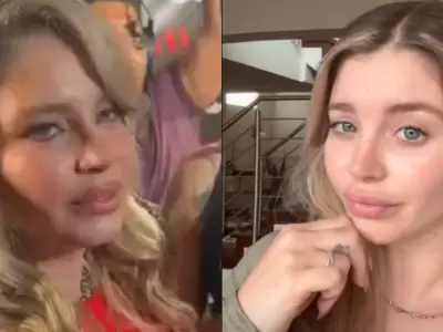 Flavia Laos habla de sus cirugas
