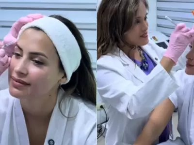 Milett se hace nuevos retoquitos