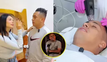 Christian Cueva se somete a retoques estticos