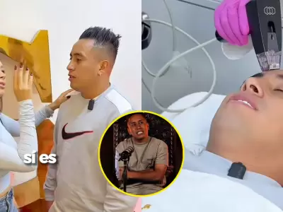 Christian Cueva se somete a retoques estticos