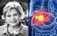 Camucha Negrete: Cmo prevenir el cncer de hgado, enfermedad que padeca la primera actriz?