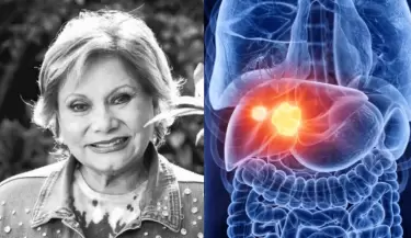 Camucha Negrete: Cmo prevenir el cncer de hgado?