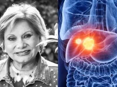 Camucha Negrete: Cmo prevenir el cncer de hgado?