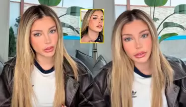 Flavia Laos revela que sufre enfermedad autoinmune.