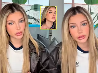 Flavia Laos revela que sufre enfermedad autoinmune.
