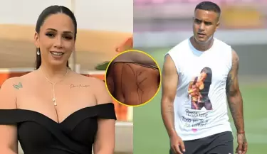 Melissa Klug sorprende a sus fans con abdominoplasta, luxacin de costillas y operacin de mamas.