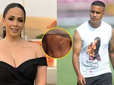 Melissa Klug sorprende a sus fans con abdominoplasta, luxacin de costillas y operacin de mamas.