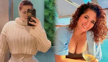 Ana Lucía Urbina reveló detalles de su cirugía estética en el rostro y cuerpo