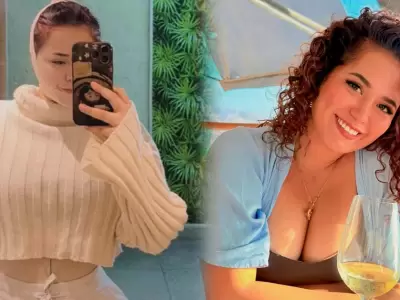 Ana Lucía Urbina reveló detalles de su cirugía estética en el rostro y cuerpo