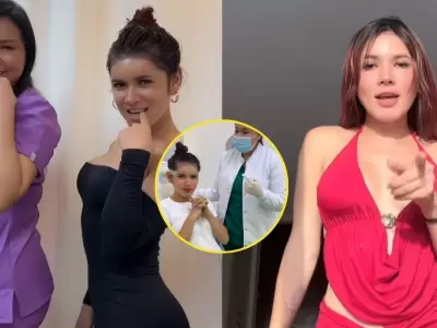 La 'Uchul' sorprende con nuevo cambio de look tras someterse a implante capilar.