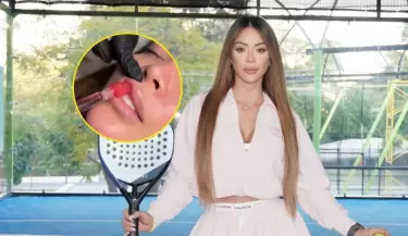 Sheyla Rojas vuelve a generar polmica tras mostrar nuevo retoque esttico y responder con firmeza a sus crticos.