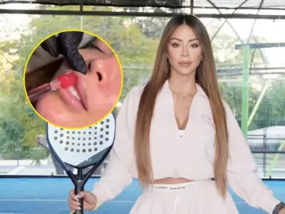 Sheyla Rojas vuelve a generar polmica tras mostrar nuevo retoque esttico y responder con firmeza a sus crticos.