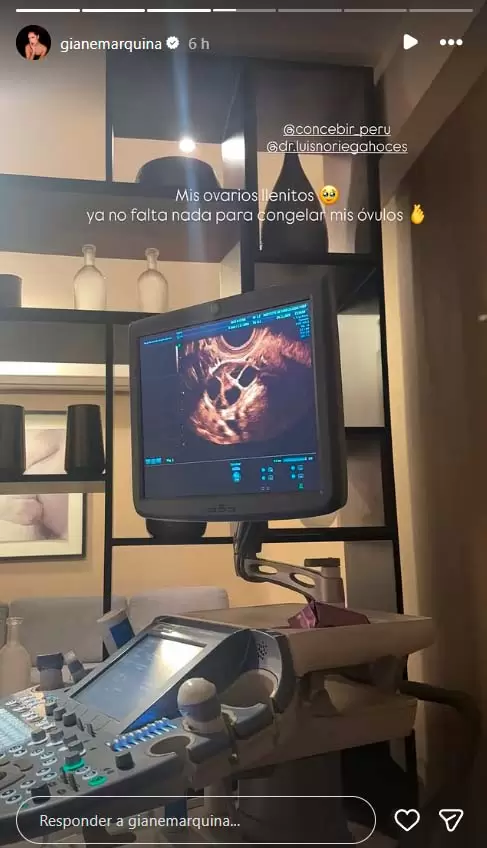 Historia de la hija de Melissa Klug