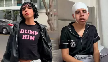 Tiktoker Valentino Palacios reaparece vendado y con el rostro hinchado