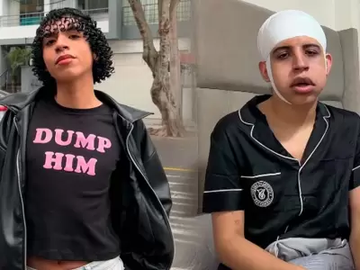 Tiktoker Valentino Palacios reaparece vendado y con el rostro hinchado