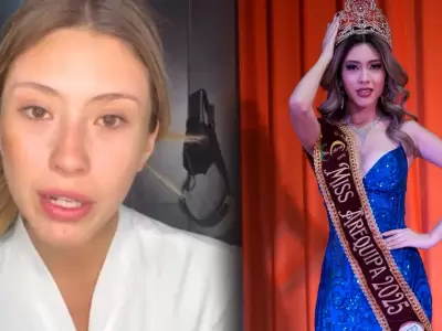 Miss Arequipa denuncia a su exnovio por violencia f�sica y psicol�gica