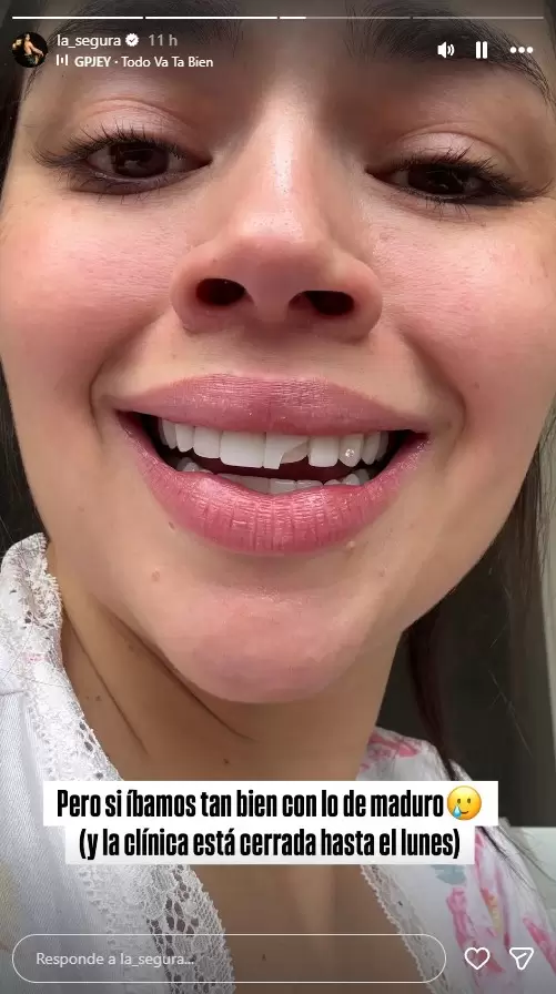 Natalia Segura 'pierde' parte de su diente tras captura de Nicol�s Maduro. (Instagram)