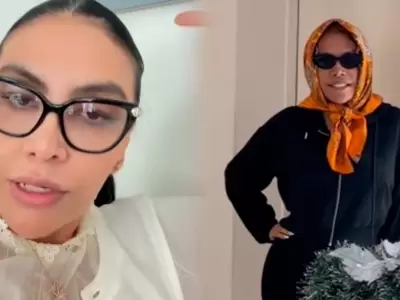 Doctora de Magaly revela c�mo sigue su recuperaci�n tras cirug�a facial