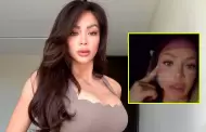 Sheyla Rojas se arrepiente de retoquito est�tico en el rostro: "Me lo quiero quitar"
