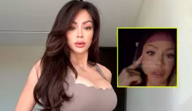 Sheyla Rojas se arrepiente de retoquito est�tico en el rostro