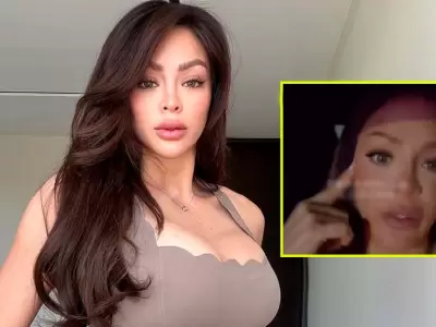 Sheyla Rojas se arrepiente de retoquito est�tico en el rostro