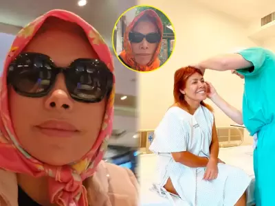 Magaly Medina aclara por qu� luce as� tras su cirug�a facial.