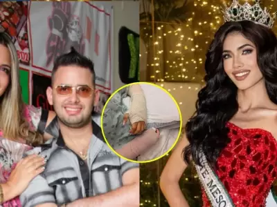 Luciana Martin se retira de certamen de belleza tras accidente con juegos artificiales.