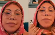 Magaly Medina estalla por rumores de varias cirug�as en su rostro y se muestra: "La mayor conchudez"