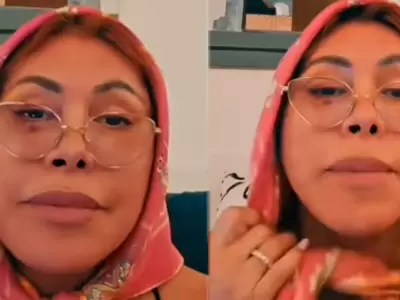 Magaly Medina responde sin filtros a rumores sobre cirug�as en su rostro.