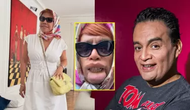 Magaly Medina se pronuncia tras parodia de JB sobre su operaci�n facial:.