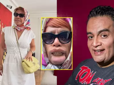 Magaly Medina se pronuncia tras parodia de JB sobre su operaci�n facial:.
