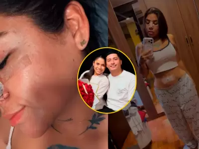 Masiel M�laga presume cambios est�ticos tras separaci�n de Hern�n Hinostroza.