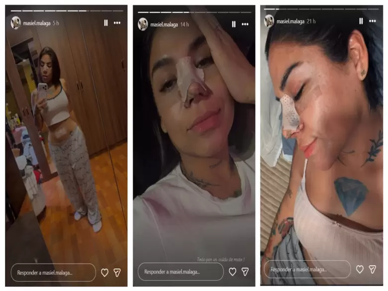 Masiel Málaga presume retoques estéticos.