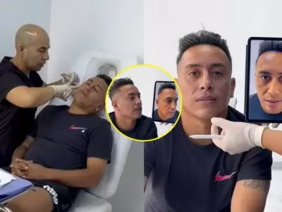 Christian Cueva sorprende al someterse a retoque est�tico y desata reacciones en redes.
