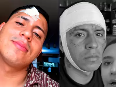 �ngel Ram�rez fue agredido en discoteca de Trujillo y reaparece con mensaje a sus fans.