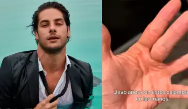Actor Andr�s Wiese comparti� im�genes de sus calambres.